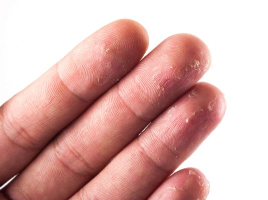 Gợi ý 4 cách chọn kem dưỡng da tay theo từng loại da